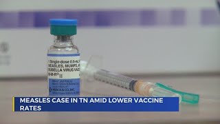 Local health experts encourage measles vaccination as state reports first case in years [upl. by Neersan820]