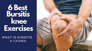 6 Best Bursitis Knee Pain Exercises amp Physiotherapy [upl. by Bringhurst548]