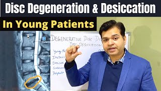 Disc Degeneration L5 S1 Disc Desiccation Disc Degeneration Causes DDDDegenerative Disc Treatment [upl. by Atteuqahs842]