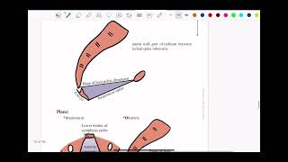 Normal labor pelvic diameters [upl. by Feinstein]