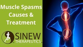 Muscle Spasms Causes and Treatment [upl. by Yendys]