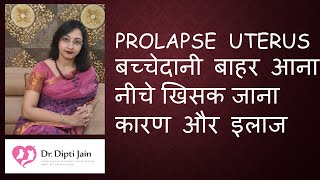 UTERINE PROLAPSE बच्चेदानी बाहर आना  नीचेखिसकजाना HINDI [upl. by Ennirroc]