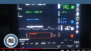 Spacelabs Qube Patient Monitor Testing [upl. by Lello141]