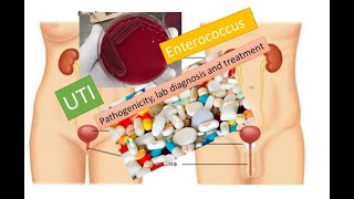 Enterococus pathogenecity lab diagnosis and treatment [upl. by Clough]