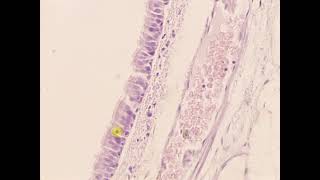 Pseudostratified columnar epithelium with cilia Trachea [upl. by Ennaesor]