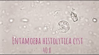 Entamoeba Histolytica cyst under microscope at 40X [upl. by Uwton127]