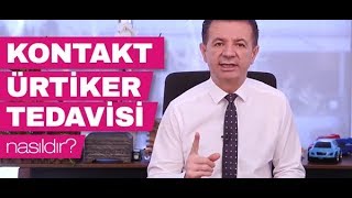 Kontakt Ürtiker Temas Ürtikeri Tedavisi Nasıldır  Prof Dr Ahmet Akçay [upl. by Engelbert]