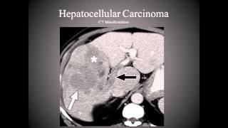 The Hepatobiliary System [upl. by Elbam]