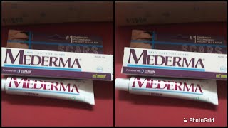 MEDERMA SCAR GEL REVIEW IN TAMIL [upl. by Delphine]