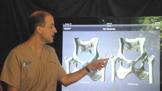 Femoral head and neck ostectomy FHO in the dog and cat [upl. by Ttelracs]