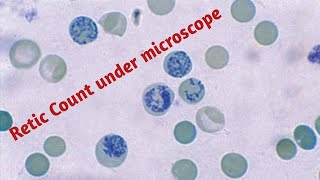 Reticulocyte  Reticulocyte count test in hindi [upl. by Jerusalem]