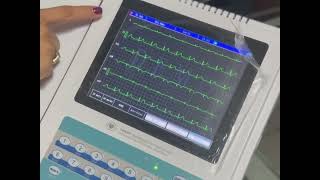 Ekg electrocardiógrafo 12 canales Contec Ecg1200G Presentación del equipo y modo de uso [upl. by Eula908]