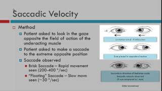 Saccadic Velocity [upl. by Jillie]