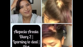 Alopecia Areata  Diary 2  Learning to Deal  Diet [upl. by Annavoig323]