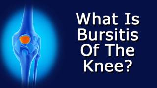 What Is Bursitis Of The Knee [upl. by Lawson377]