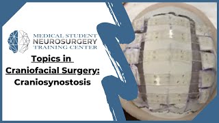 Topics in Craniofacial Surgery Craniosynostosis [upl. by Pattani477]