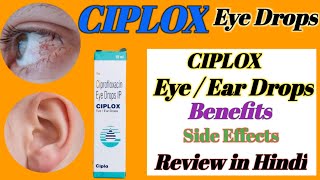 Ciplox Eye  Ear Drops Review in hindi  Ciplox Eye Drops benefitsside effecthealth [upl. by Archangel901]