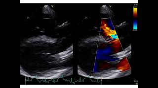 A case of Tetralogy Fallot in a Basset Hound puppy [upl. by Joacima]