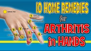 10 Home Remedies for Arthritis in Hands  Pain Relief Diet [upl. by Dysart]