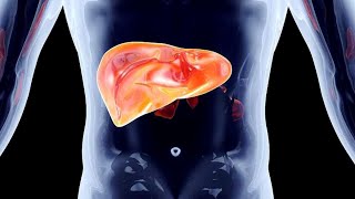 Mayo Clinic Minute When colon cancer spreads to the liver [upl. by Costin82]