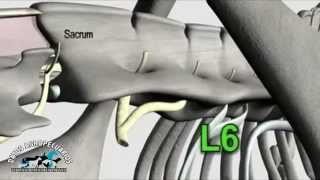 Anestesia epidural en Bovinos [upl. by Strohl262]