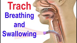 Trach Breathing and Swallowing [upl. by Barris]