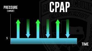 Short and Simple CPAP vs BiPAP [upl. by France]