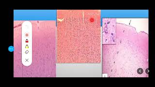 Histology Slides Series Episode 17  Histology of Nervous Tissues including Peripheral Nerves [upl. by Barstow561]