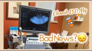 “FOLLICLE SCAN  Clomid 150 mg WILL I GET THE OVIDREL SHOT [upl. by Hulda603]