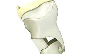 Hyoid Bone Elevation from 3D Swallow [upl. by Tipton]