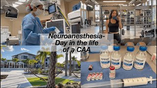 Behind the Scenes Neurosurgery with an Anesthesiologist Assistant Day in the life vlog [upl. by Rann]