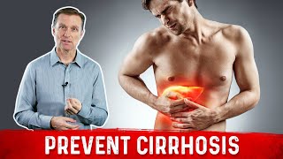 Best Herbs for Liver Cirrhosis [upl. by Monie]