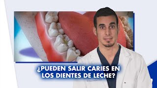 ¿Hay que tratar las CARIES en los DIENTES DE LECHE ¿Se puede usar ORTODONCIA  Shorts [upl. by Avad]