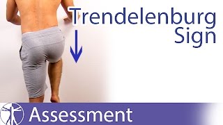 Trendelenburg Sign  Hip Abductor Weakness [upl. by Rodi171]