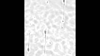 Axon growth cone of primary rat hippocampal neurons on Motility CYTOOchips [upl. by Rebel]