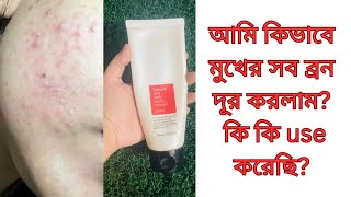 cosrx salicylic acid daily gentle cleanser reviewhow to use cosrx salicylic acid cleanse Bangla [upl. by Justine507]