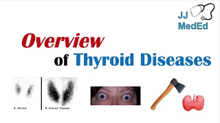 Overview of Thyroid Diseases Hashimoto’s Graves’ Sick Euthyroid Syndrome Toxic adenoma etc [upl. by Anoniw971]