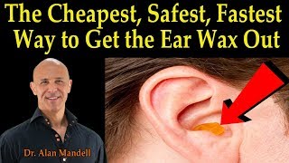 Cheapest Safest Fastest Way to Get the Ear Wax Out  Dr Alan Mandell DC [upl. by Speroni]