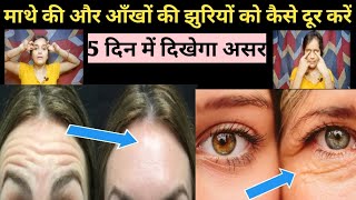 How To Remove Forehead amp Eye Wrinkles ❓️माथे और आंखों की झुर्रियां 5 दिन में गायब करने का सरल तरीका [upl. by Petunia]