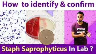 How to identify amp Confirm Staphylococcus Saprophytes in Laboratory [upl. by Adallard392]