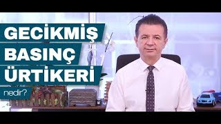 Gecikmiş Basınç Ürtikeri Nedir  Prof Dr Ahmet Akçay [upl. by Carolina]