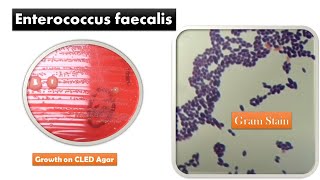 Enterococcus faecalis Colony Morphology and Gram Staining [upl. by Evanthe596]