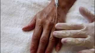 Hand Injection Using Cannula Injection Techniqe [upl. by Gemoets266]