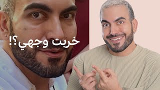 شو صار بوجهي بعد الحقن؟ 😱 [upl. by Mueller]