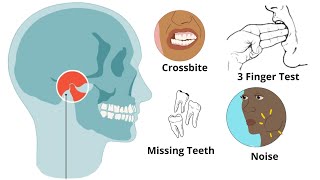 Is Your Jaw UNBALANCED  Uneven Jaw Causes Treatments MUST KNOW [upl. by Adnuhsed350]