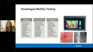 Elevating Esophageal Manometry Incorporating of Chicago 4 0 Protocol [upl. by Bajaj]