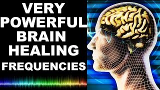 EXTREME BRAIN HEALING FREQUENCIES FOR STUDY FOCUS MIND POWER CONFIDENCE MEDITATION  MUST TRY [upl. by Krever351]