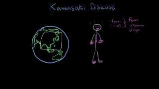 What Is Kawasaki Disease [upl. by Dove16]