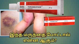 Thrombophob ointment uses in tamilThrombophob ointment benefits in tamilThrombophob ointment uses [upl. by Jegger852]