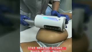 Cellulite Treatment Miami  EndoSpheres Technology [upl. by Toolis709]